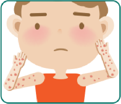 Illustration of a child with skin irritation, showing red spots on arms and face, highlighting the importance of skin care. Nippon Paint products can help create a healthier indoor environment to prevent allergies and irritations.
